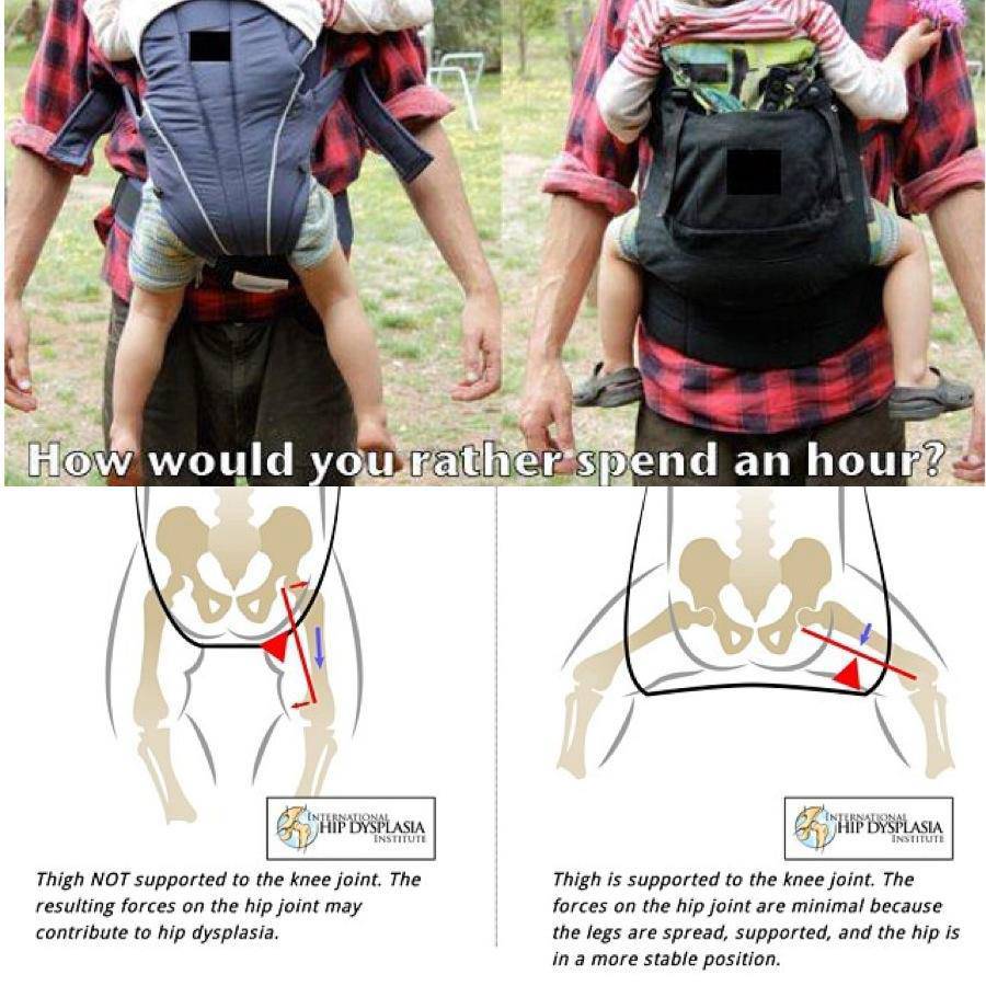 como saber se o meu canguru e ergonomico 2
