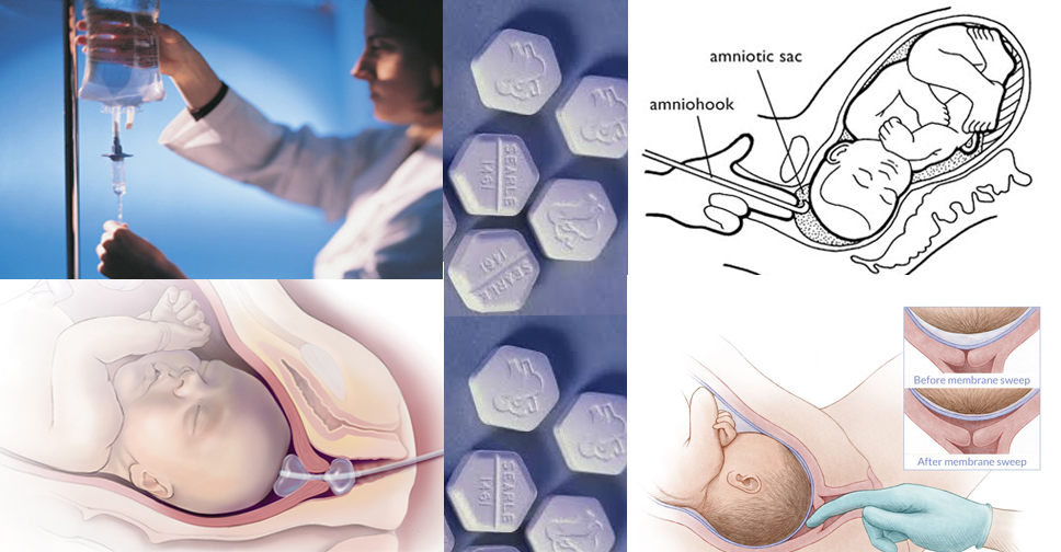 Formas de Induzir o Parto no Hospital